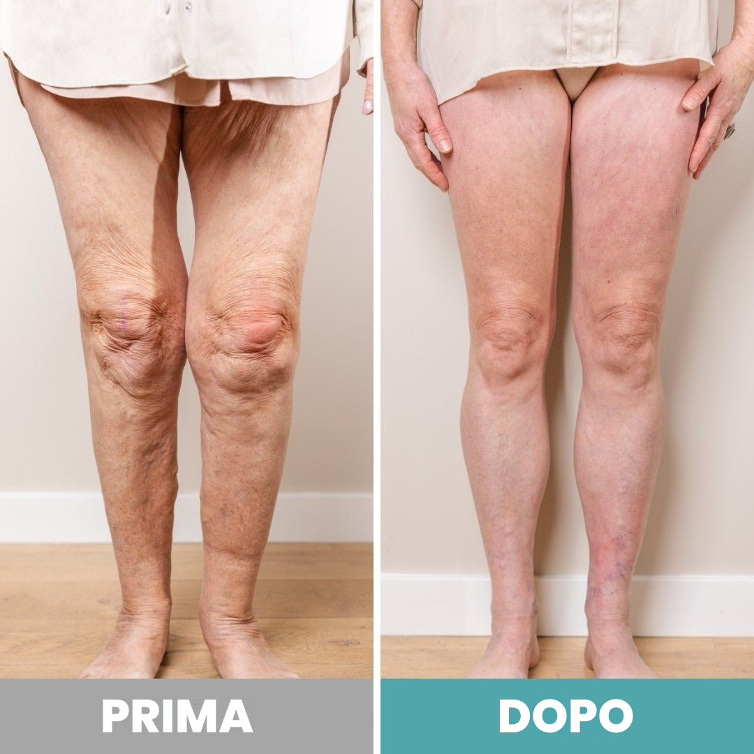 Massaggiatore Plantare Elettrico